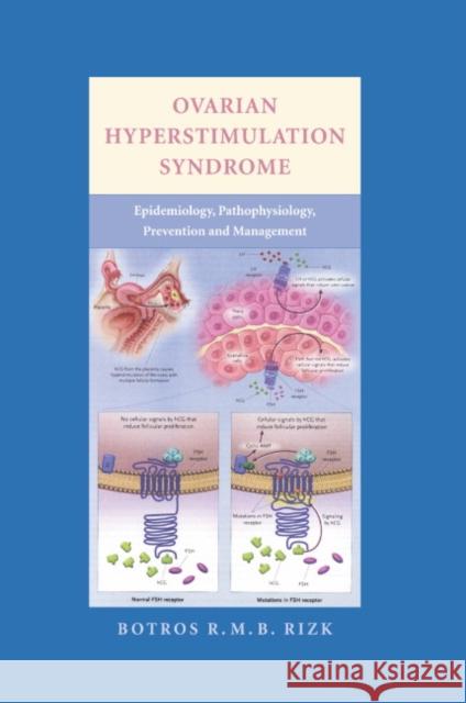 Ovarian Hyperstimulation Syndrome: Epidemiology, Pathophysiology, Prevention and Management Rizk, Botros 9780521857987 Cambridge University Press - książka