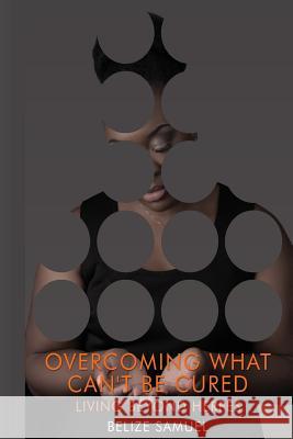 Overcoming What Can't be Cured: Living Beyond Herpes Samuel, Belize 9781537596266 Createspace Independent Publishing Platform - książka