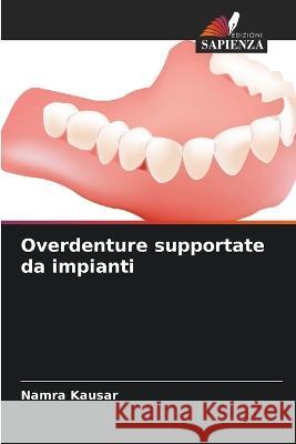 Overdenture supportate da impianti Namra Kausar   9786206243144 Edizioni Sapienza - książka
