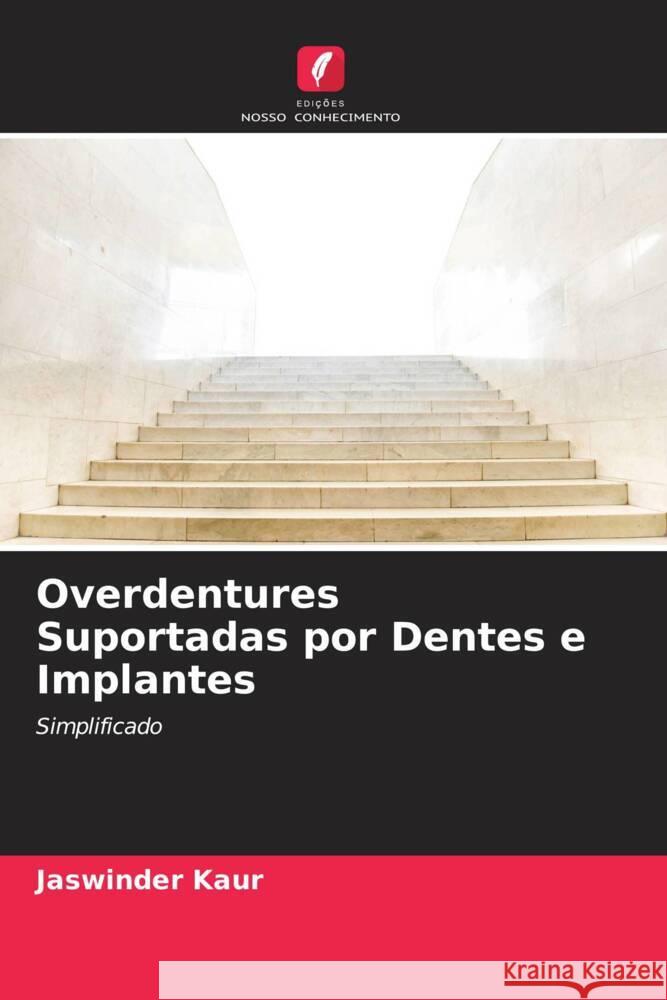 Overdentures Suportadas por Dentes e Implantes Kaur, Jaswinder 9786204907765 Edições Nosso Conhecimento - książka