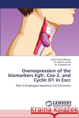 Overexpression of the biomarkers Egfr, Cox-2, and Cyclin D1 in Escc Tariq Manzoor, Zainab 9786139814138 LAP Lambert Academic Publishing - książka