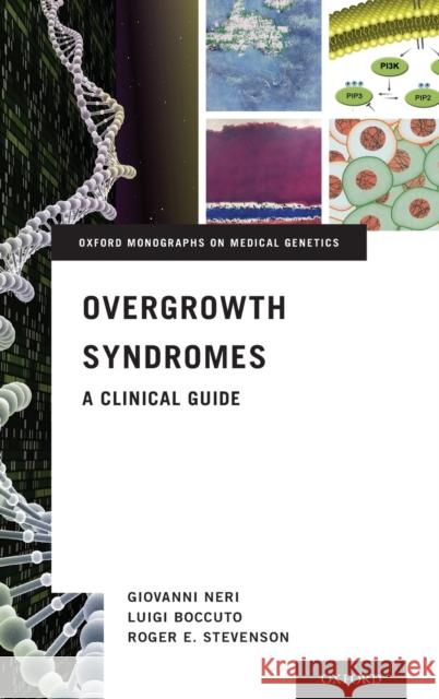 Overgrowth Syndromes: A Clinical Guide Giovanni Neri Luigi Boccuto Roger E. Stevenson 9780190944896 Oxford University Press, USA - książka
