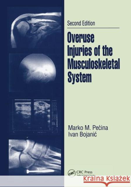 Overuse Injuries of the Musculoskeletal System, Second Edition Marko M. Pecina Ivan Bojanic 9780367446680 CRC Press - książka