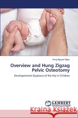 Overview and Hung Zigzag Pelvic Osteotomy Nguyen Ngoc, Hung 9786139582587 LAP Lambert Academic Publishing - książka