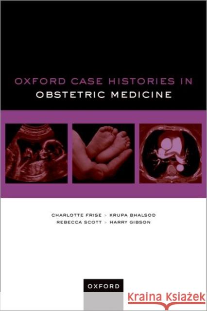Oxford Case Histories in Obstetric Medicine Harry (Consultant in Obstetrics and Gynaecology with a specialist interest in Obstetric Medicine, Consultant in Obstetri 9780192845894 Oxford University Press - książka