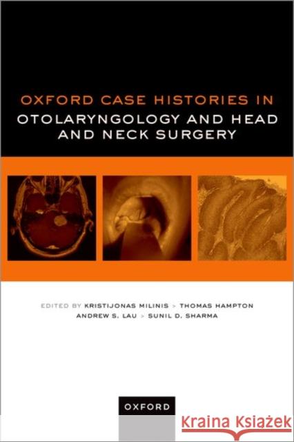 Oxford Case Histories in Otolaryngology and Head and Neck Surgery Dr Sunil D. (Consultant Paediatric ENT Surgeon, Alder Hey Children's Hospital, Liverpool, UK) Sharma 9780192888709 Oxford University Press - książka