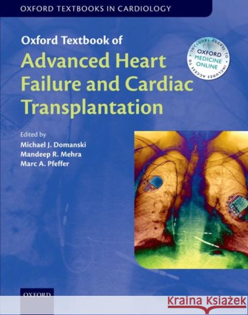 Oxford Textbook of Advanced Heart Failure and Cardiac Transplantation Michael Domanski Mandeep R. Mehra Marc Pfeffer 9780198734871 Oxford University Press, USA - książka