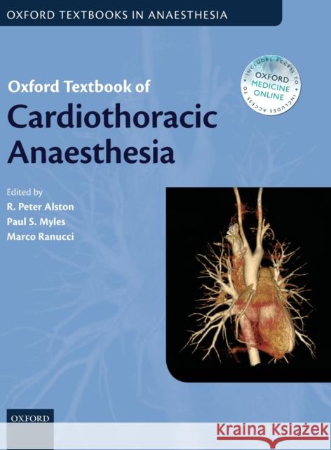 Oxford Textbook of Cardiothoracic Anaesthesia Marco Ranucci R. Peter Alston Paul S. Myles 9780199653478 Oxford University Press, USA - książka