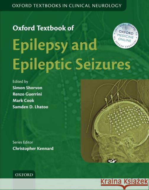 Oxford Textbook of Epilepsy and Epileptic Seizures Simon Shorvon 9780199659043  - książka