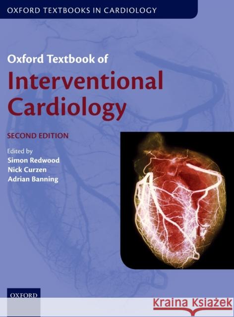 Oxford Textbook of Interventional Cardiology Redwood, Simon 9780198754152 Oxford University Press, USA - książka