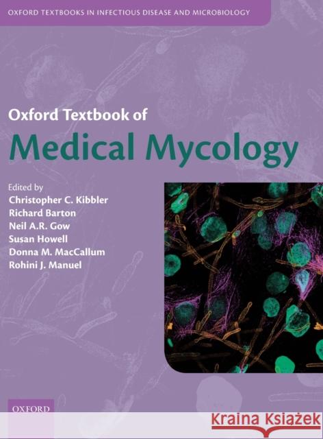 Oxford Textbook of Medical Mycology Christopher C. Kibbler Richard Barton Neil Gow 9780198755388 Oxford University Press, USA - książka