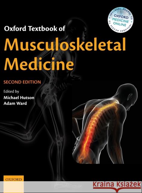 Oxford Textbook of Musculoskeletal Medicine Michael Hutson Adam Ward 9780199674107 Oxford University Press, USA - książka