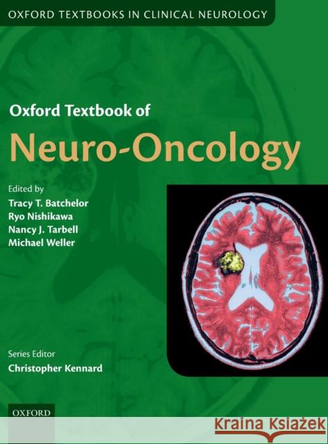 Oxford Textbook of Neuro-Oncology Tracy Batchelor Ryo Nishikawa Nancy Tarbell 9780199651870 Oxford University Press, USA - książka