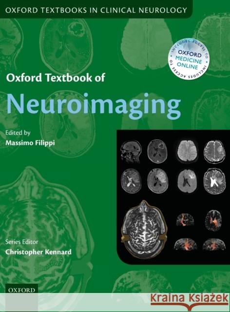 Oxford Textbook of Neuroimaging Massimo Filippi 9780199664092 Oxford University Press, USA - książka