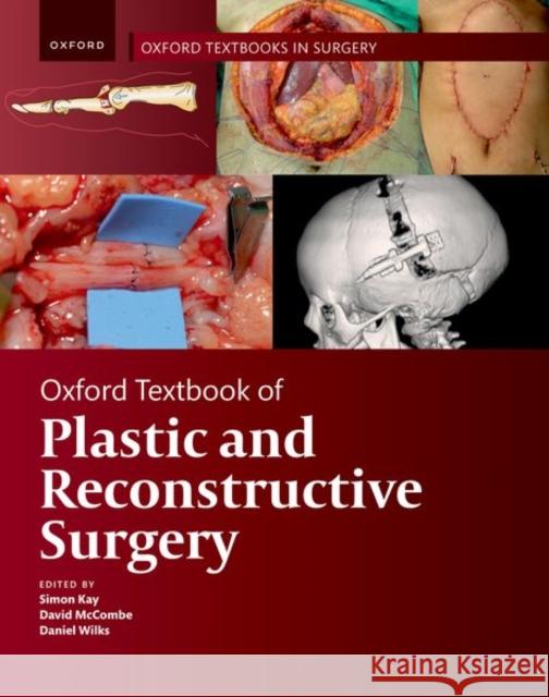Oxford Textbook of Plastic and Reconstructive Surgery  9780198906179 OUP OXFORD - książka