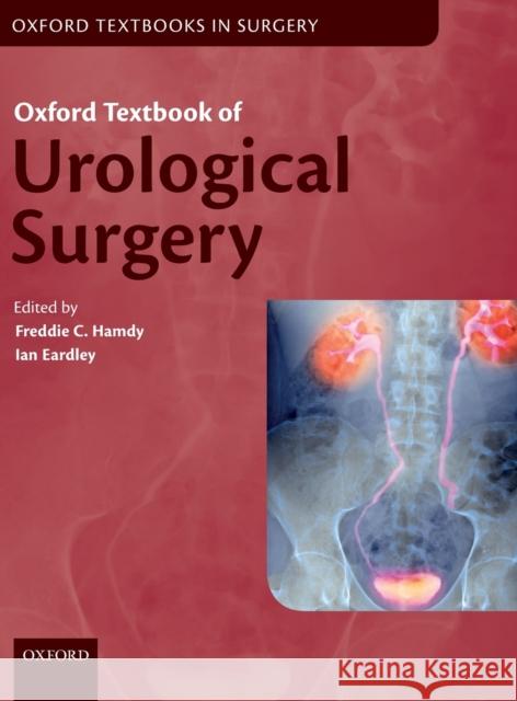 Oxford Textbook of Urological Surgery Freddie C. Hamdy Ian Eardley 9780199659579 Oxford University Press, USA - książka