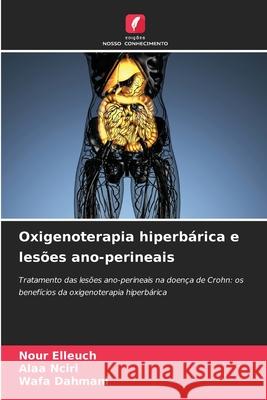Oxigenoterapia hiperbárica e lesões ano-perineais Elleuch, Nour, Nciri, Alaa, Dahmani, Wafa 9786208660758 Edições Nosso Conhecimento - książka