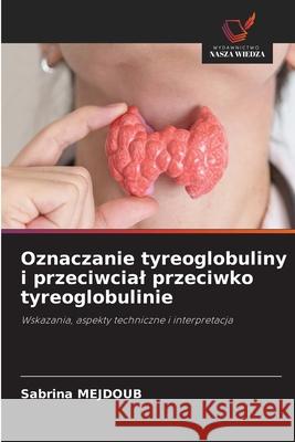 Oznaczanie tyreoglobuliny i przeciwcial przeciwko tyreoglobulinie MEJDOUB, Sabrina 9786208873219 Wydawnictwo Nasza Wiedza - książka