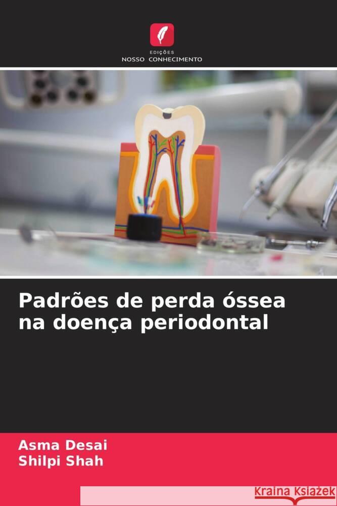 Padr?es de perda ?ssea na doen?a periodontal Asma Desai Shilpi Shah 9786206999683 Edicoes Nosso Conhecimento - książka