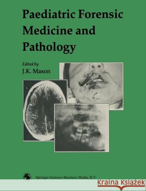 Paediatric Forensic Medicine and Pathology J. K. Mason 9780412291609 CRC Press - książka