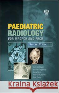 Paediatric Radiology for MRCPCH and FRCR, Second Edition Schelvan, Christopher 9781853157028  - książka