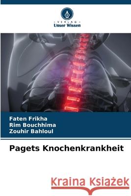 Pagets Knochenkrankheit Frikha, Faten, Bouchhima, Rim, Bahloul, Zouhir 9786202325424 Verlag Unser Wissen - książka