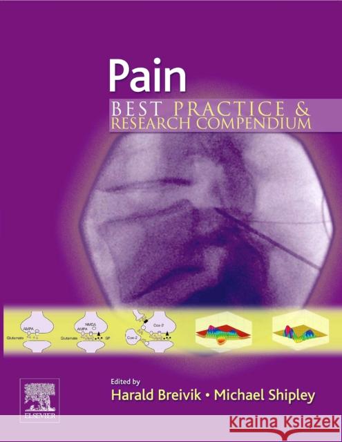 Pain: Best Practice & Research Compendium Breivik, Harald 9780080446844 Elsevier - książka