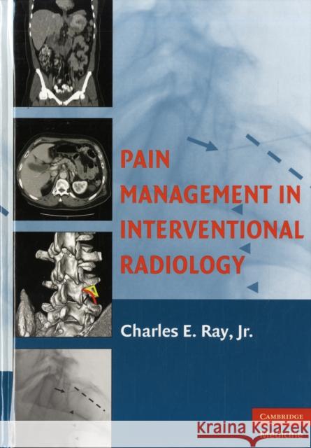 Pain Management in Interventional Radiology Charles E Ray 9780521865920  - książka