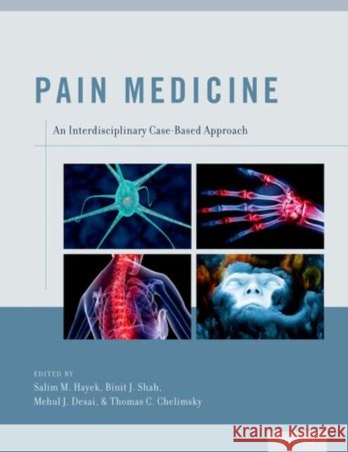 Pain Medicine: An Interdisciplinary Case-Based Approach Hayek, Salim M. 9780199931484 Oxford University Press, USA - książka