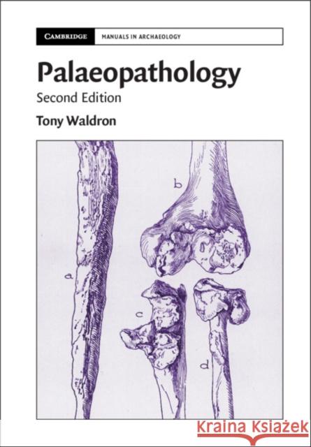 Palaeopathology Waldron Tony Waldron 9781108499583 Cambridge University Press - książka