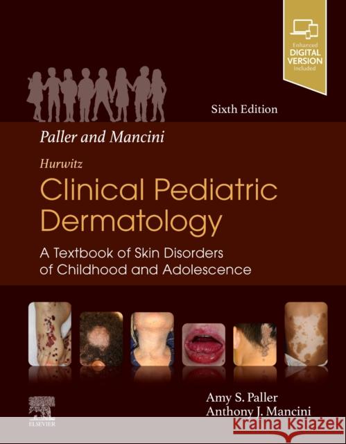 Paller and Mancini - Hurwitz Clinical Pediatric Dermatology: A Textbook of Skin Disorders of Childhood & Adolescence Amy S. Paller Anthony J. Mancini 9780323549882 Elsevier - książka