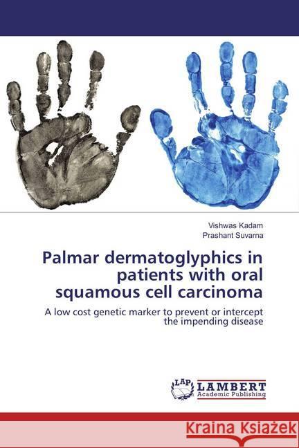 Palmar dermatoglyphics in patients with oral squamous cell carcinoma : A low cost genetic marker to prevent or intercept the impending disease Kadam, Vishwas; Suvarna, Prashant 9783659850868 LAP Lambert Academic Publishing - książka