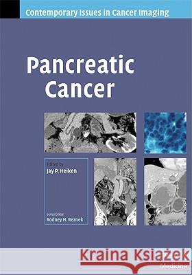 Pancreatic Cancer Jay P Heiken 9780521886925  - książka