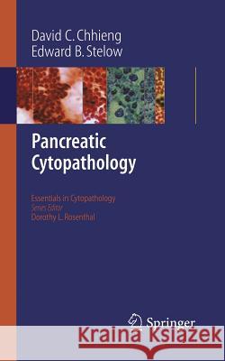 Pancreatic Cytopathology David C. Chhieng Edward B. Stelow 9780387689463 Springer - książka