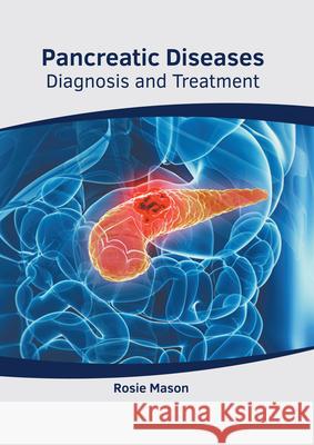 Pancreatic Diseases: Diagnosis and Treatment Rosie Mason 9781639271986 American Medical Publishers - książka