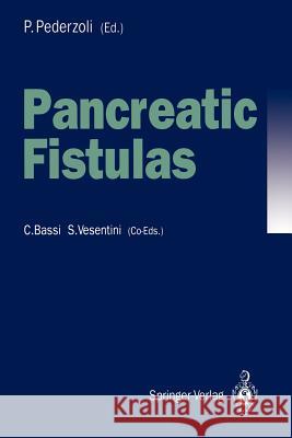 Pancreatic Fistulas Paolo Pederzoli 9783540553380 Springer - książka