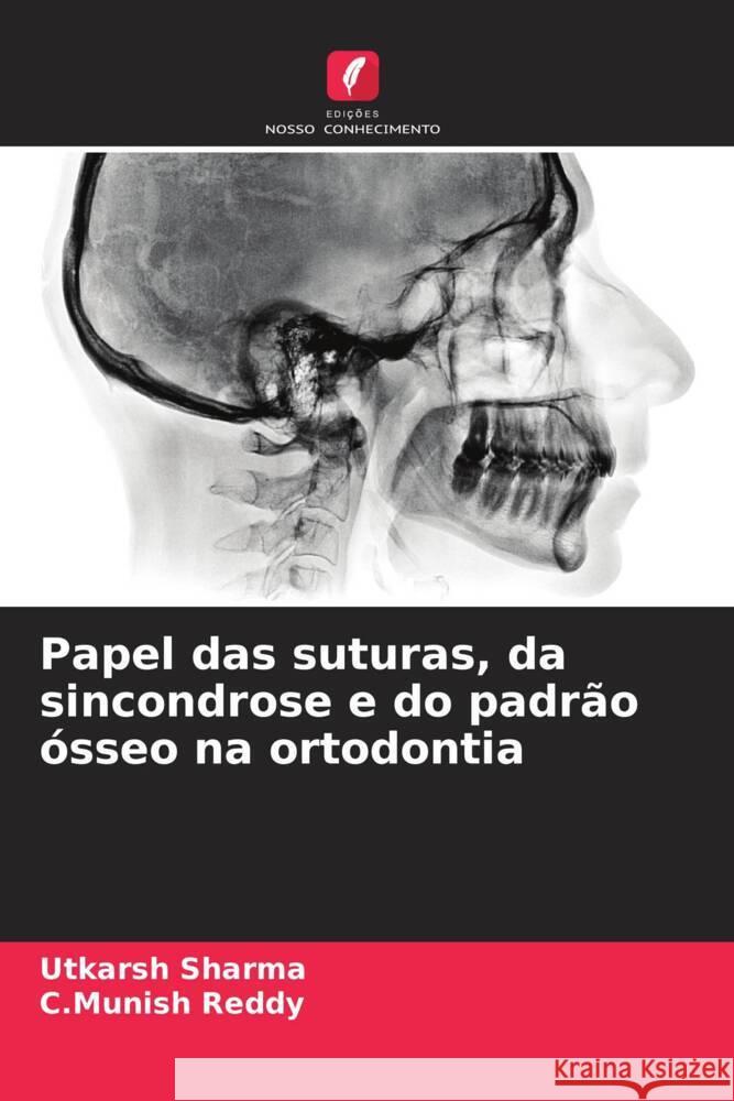 Papel das suturas, da sincondrose e do padr?o ?sseo na ortodontia Utkarsh Sharma C. Munish Reddy 9786206961413 Edicoes Nosso Conhecimento - książka