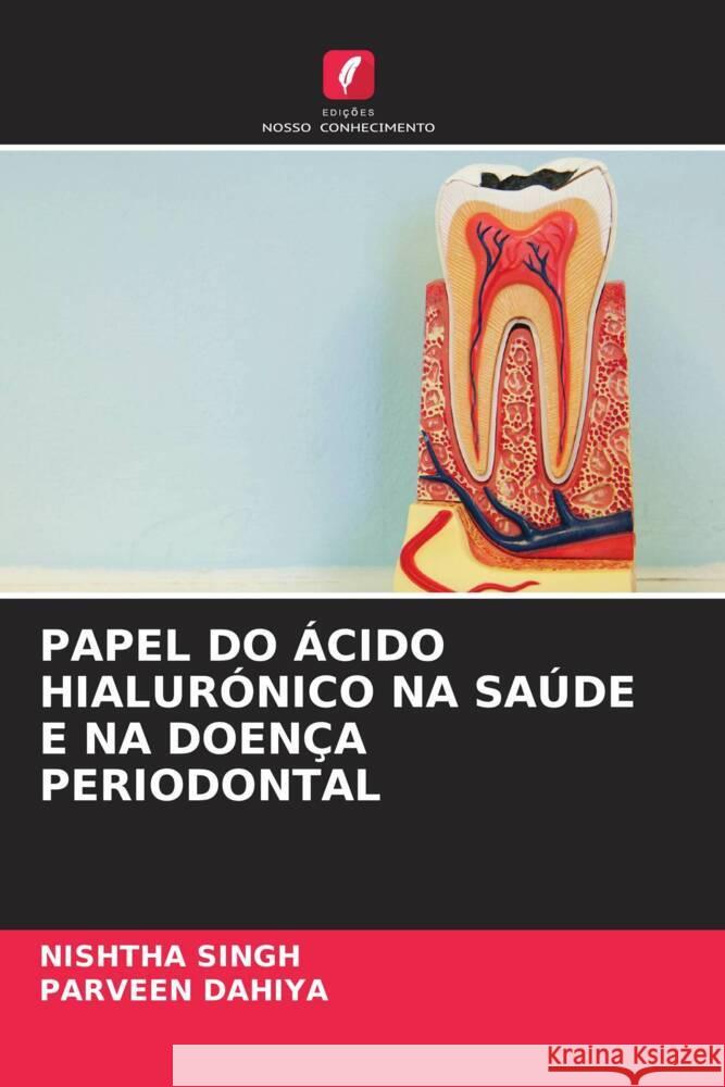 PAPEL DO ÁCIDO HIALURÓNICO NA SAÚDE E NA DOENÇA PERIODONTAL Singh, Nishtha, Dahiya, Parveen 9786205470060 Edições Nosso Conhecimento - książka