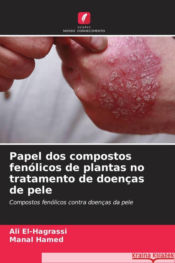 Papel dos compostos fen?licos de plantas no tratamento de doen?as de pele Ali El-Hagrassi Manal Hamed 9786206884347 Edicoes Nosso Conhecimento - książka