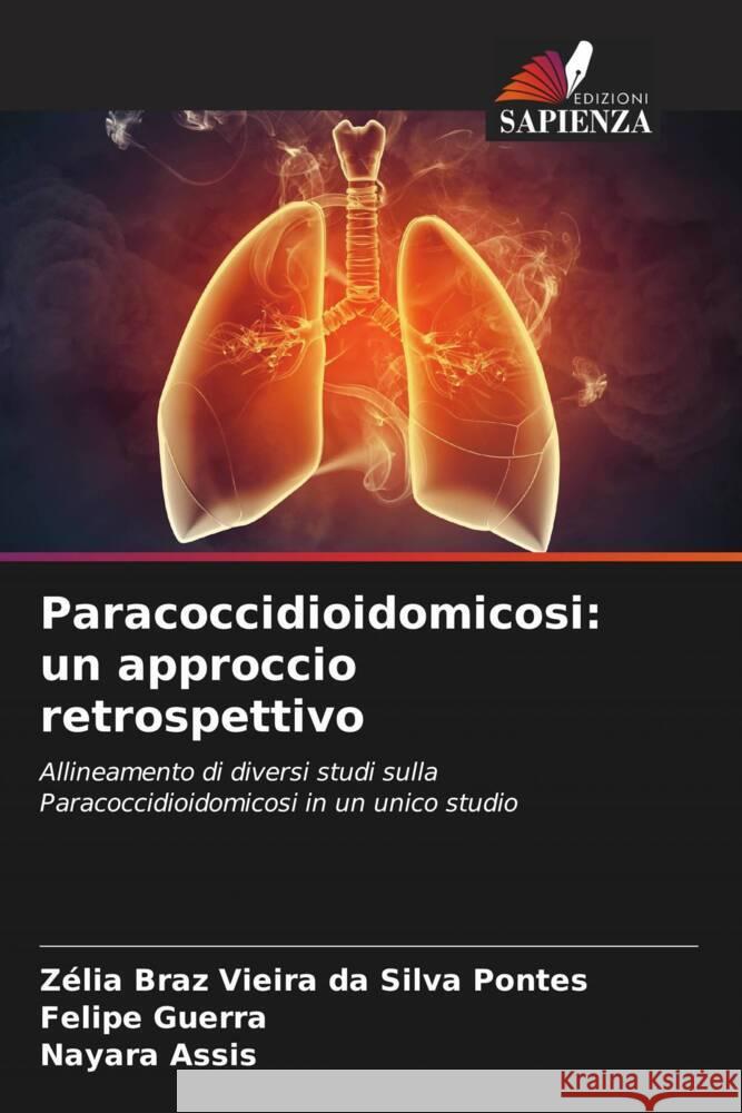 Paracoccidioidomicosi: un approccio retrospettivo Z?lia Bra Felipe Guerra Nayara Assis 9786207253951 Edizioni Sapienza - książka