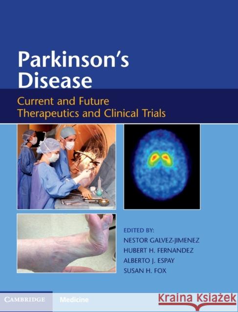 Parkinson's Disease: Current and Future Therapeutics and Clinical Trials Nestor Galvez-Jimenez Hubert Fernandez Alberto Espay 9781107053861 Cambridge University Press - książka