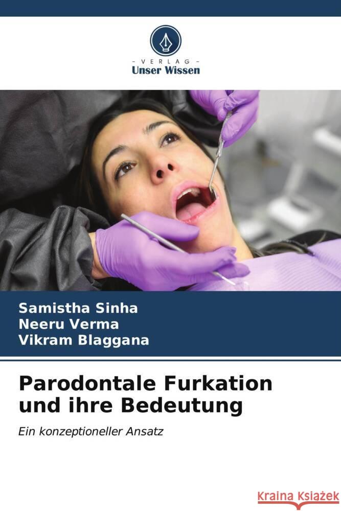 Parodontale Furkation und ihre Bedeutung Sinha, Samistha, Verma, Neeru, Blaggana, Vikram 9786206528616 Verlag Unser Wissen - książka