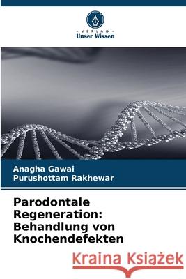 Parodontale Regeneration: Behandlung von Knochendefekten Gawai, Anagha, Rakhewar, Purushottam 9786208808488 Verlag Unser Wissen - książka