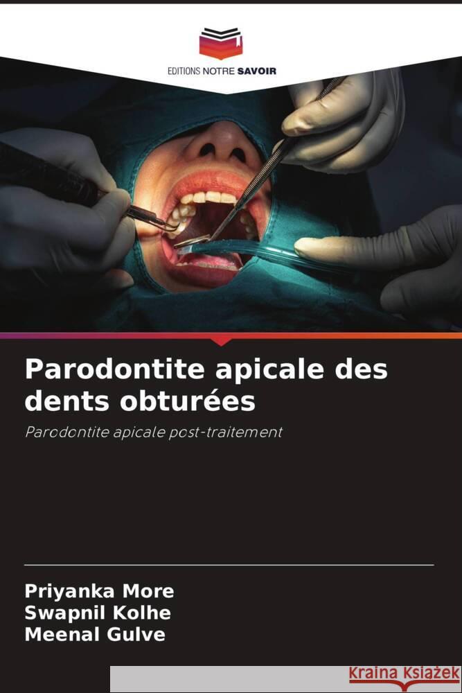 Parodontite apicale des dents obtur?es Priyanka More Swapnil Kolhe Meenal Gulve 9786208047191 Editions Notre Savoir - książka