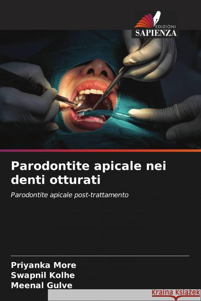 Parodontite apicale nei denti otturati Priyanka More Swapnil Kolhe Meenal Gulve 9786208047207 Edizioni Sapienza - książka