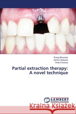 Partial extraction therapy: A novel technique Bhourkar, Rutuja, Aidasani, Ashwin, Choukse, Vivek 9786207995028 LAP Lambert Academic Publishing - książka