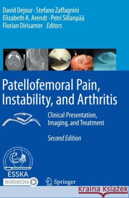 Patellofemoral Pain, Instability, and Arthritis: Clinical Presentation, Imaging, and Treatment David Dejour Stefano Zaffagnini Elizabeth A. Arendt 9783662610992 Springer - książka