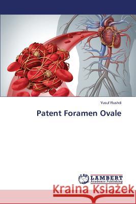 Patent Foramen Ovale Rushdi Yusuf 9783659832697 LAP Lambert Academic Publishing - książka