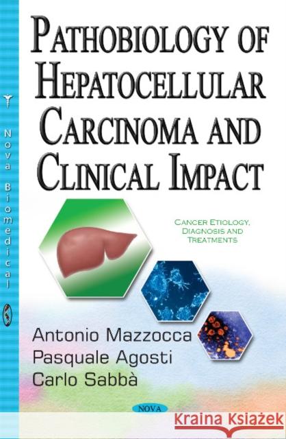 Pathobiology of Hepatocellular Carcinoma & Clinical Impact Antonio Mazzocca, Pasquale Agosti, Carlo Sabbá 9781536100020 Nova Science Publishers Inc - książka