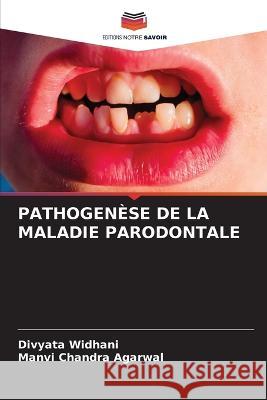 Pathogenese de la Maladie Parodontale Divyata Widhani Manvi Chandra Agarwal  9786205871409 Editions Notre Savoir - książka